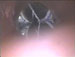 My ANSA Rick Quire Broken Drain Video Thumb